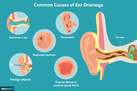 ear leaking clear fluid no pain|Ear drainage: Types, causes, and treatment